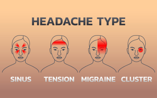 type of headache