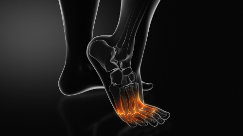 chiropractic peripheral neuropathy