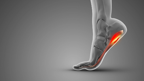 plantar fasciitis chiropractic