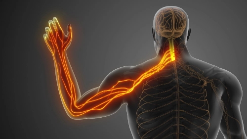 Cervical Radiculopathy Relief Through Chiropractic Care